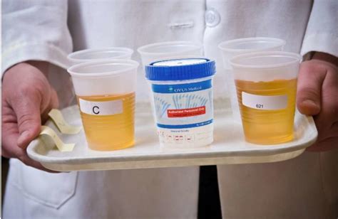 Urine dilution is a matter of increasing the concentration of pure water in your system. . Diluted urine military reddit